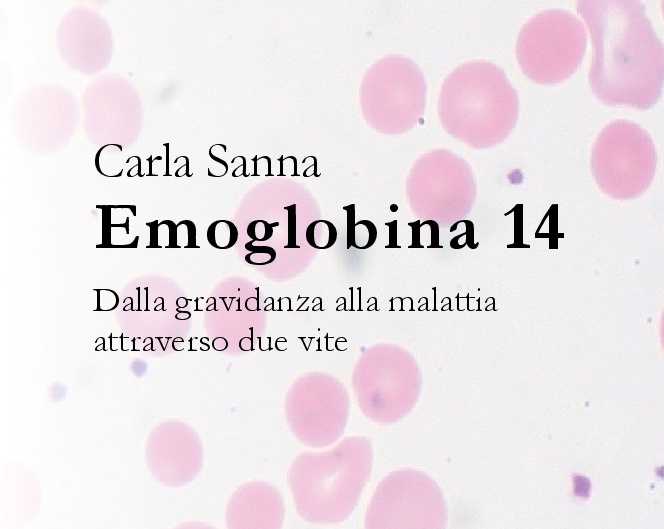 emoglobina 14